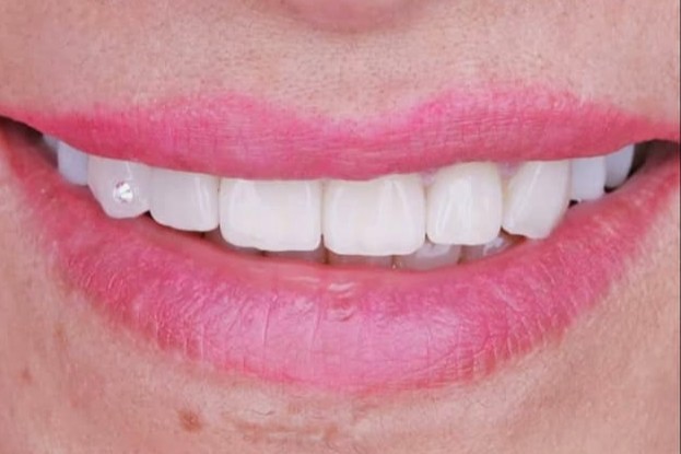 Before: case 24