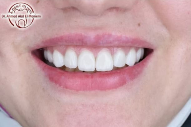 Before: case 23